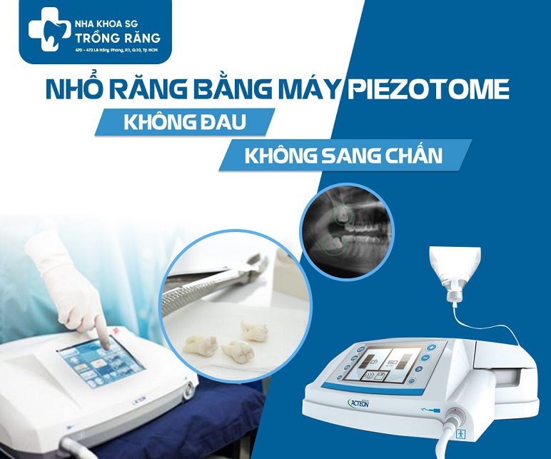 Nhổ răng bằng máy siêu âm Piezotome Nhổ răng bằng máy siêu âm Piezotome