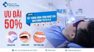 Tẩy trắng răng ưu đãi 50% chi phí - banner nha khoa
