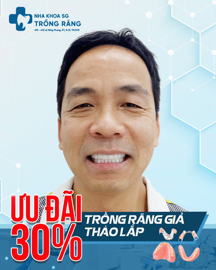 Trồng răng giả tháo lắp khuyến mãi giá rẻ