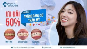 Trồng răng sứ thẩm mỹ ưu đãi 50% chi phí - banner nha khoa