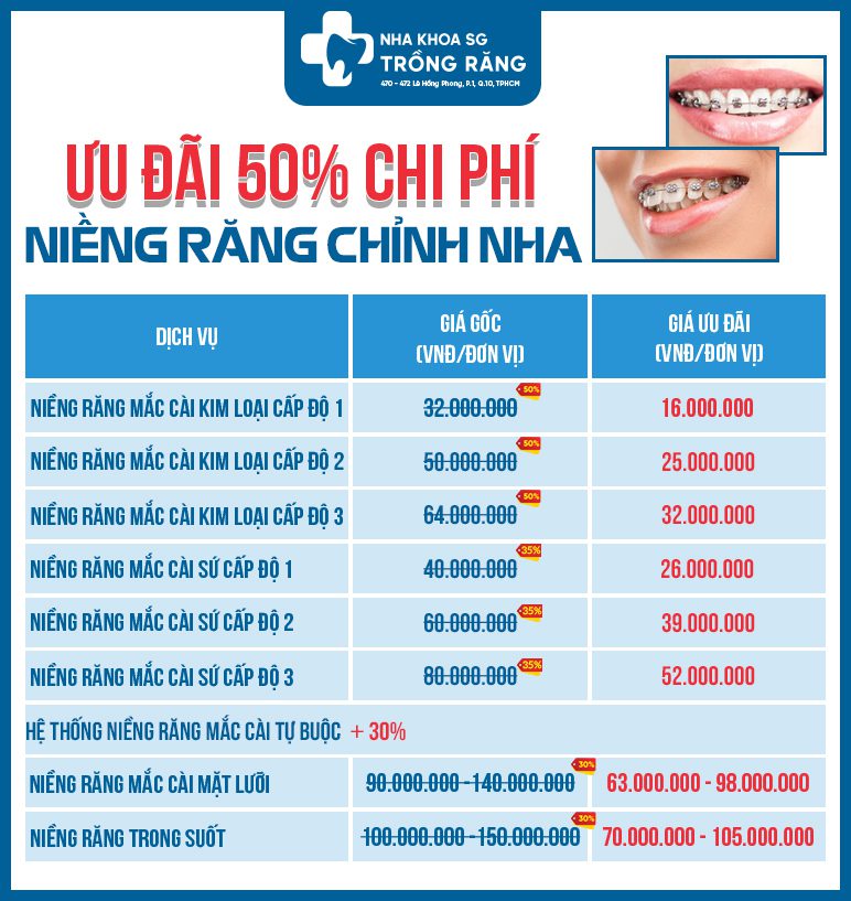 bang gia nieng rang Bảng giá niềng răng chỉnh nha