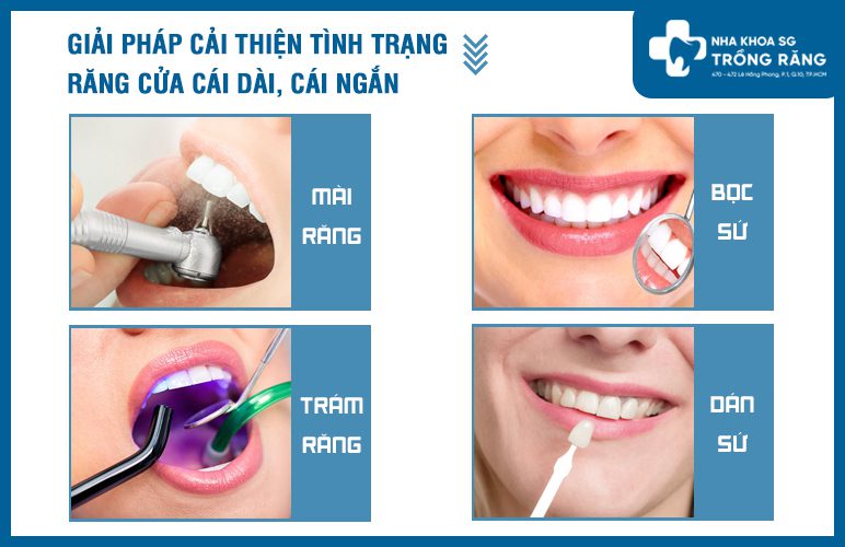 Các phương pháp điều trị răng cửa dài ngằn