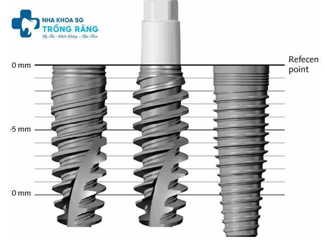 Cau tao ren Implant Cấu tạo ren Implant