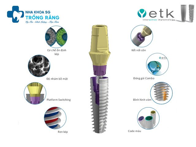 Trong rang Implant Phap ETK Trồng răng Implant Pháp ETK