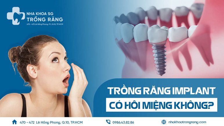 Trồng răng Implant có bị hôi miệng không Trồng răng Implant có bị hôi miệng không