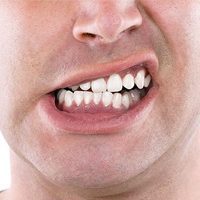 nghiến răng mô phỏng
