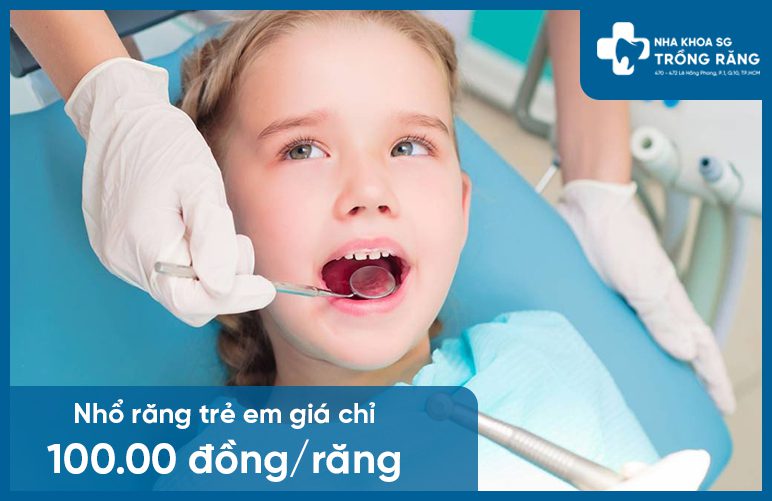 Giá nhổ răng trẻ em