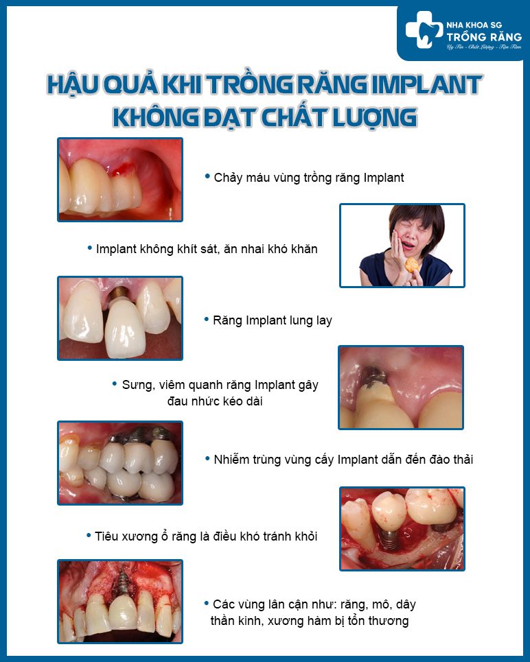 Hậu quả trồng răng implant không đạt chất lượng
