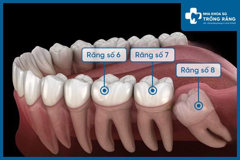 Vi tri rang so 7 Vị trí răng số 7