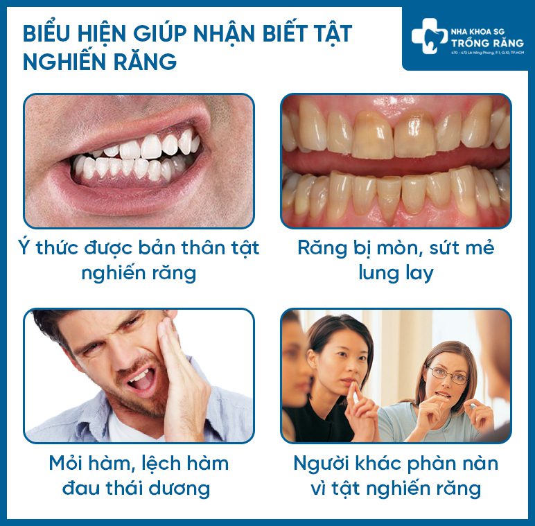 Biểu hiện nhận biết tật nghiến răng