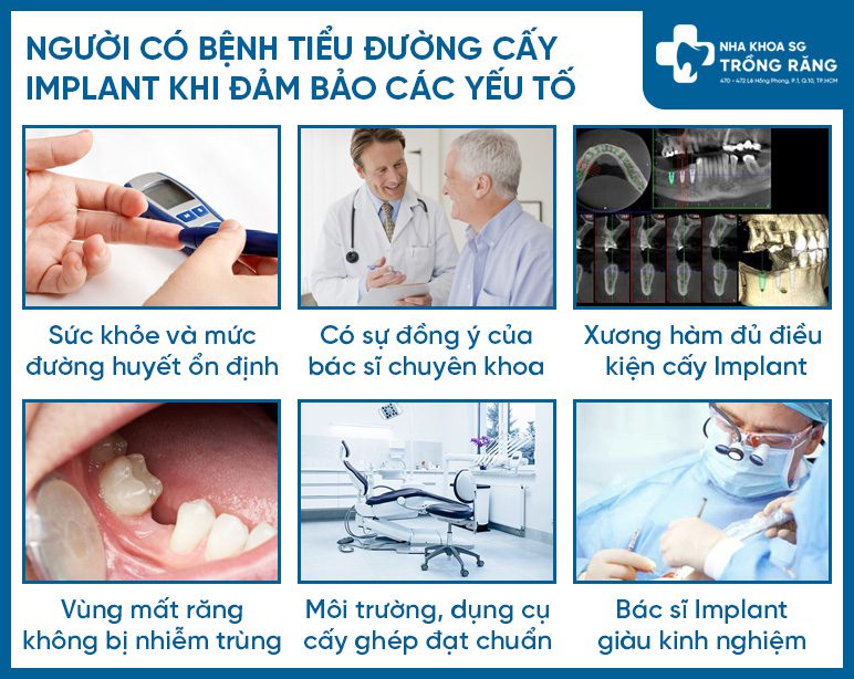 Dieu kien cay ghep rang Implant Điều kiện cấy ghép răng Implant