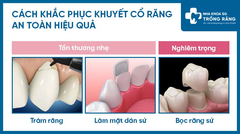 Các phương pháp điều trị khuyết cổ răng
