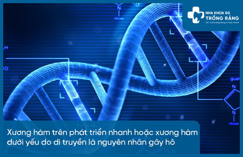 Ho co phai do di truyen khong Hô có phải do di truyền không