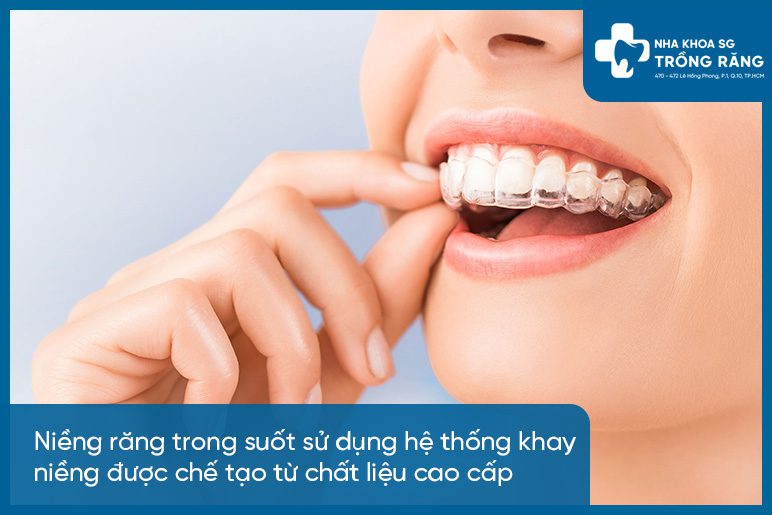 Uu diem nieng rang trong suot Ưu điểm niềng răng trong suốt