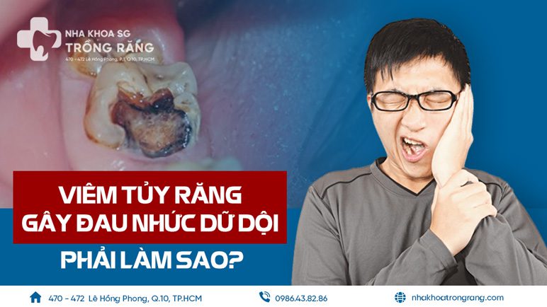 Viêm tủy răng gây đau nhức dữ dội và cách điều trị