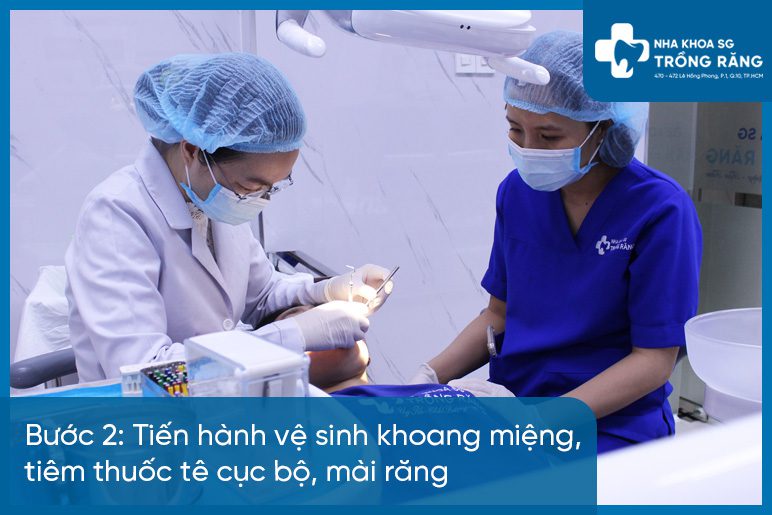 Bước 2 bọc răng sứ