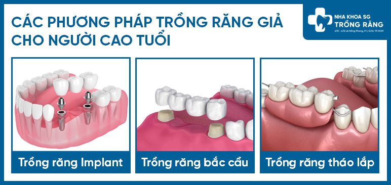 Các giải pháp trồng răng giả cho người cao tuổi Các giải pháp trồng răng giả cho người cao tuổi