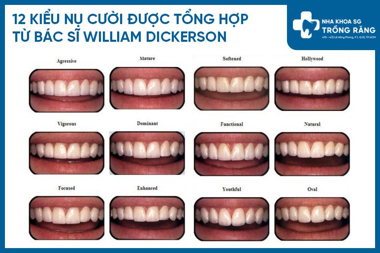 Cac kieu cuoi Các kiểu cười