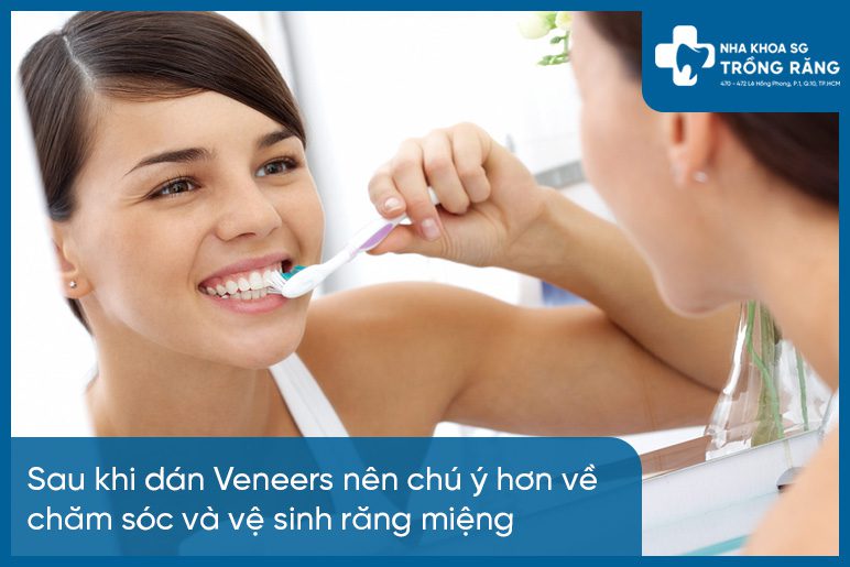 Cham soc khau khi dan rang su veneer Dán răng sứ veneer - tất tần tật thông tin cần biết