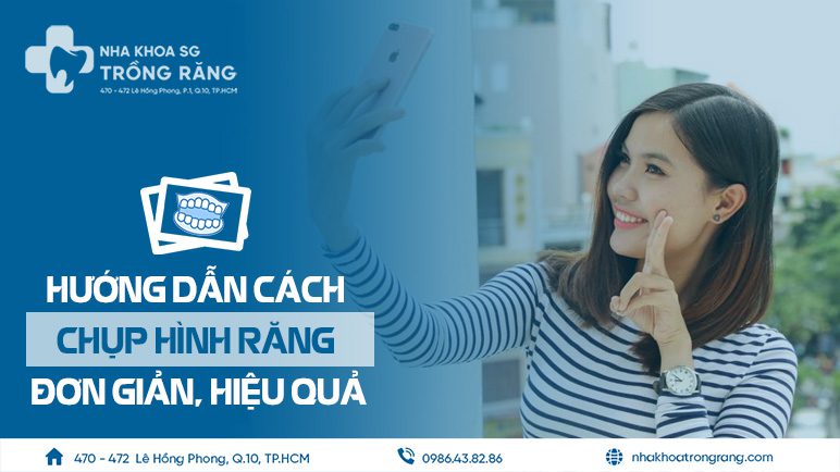 Hướng dẫn cách chụp hình răng tư vấn online Hướng dẫn cách chụp hình răng tư vấn online