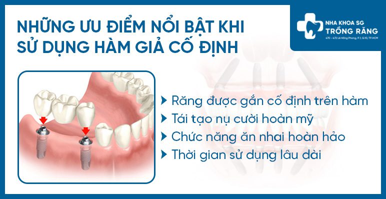 Ưu điểm hàm giả cố định