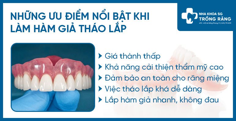 Ưu điểm hàm giả tháo lắp