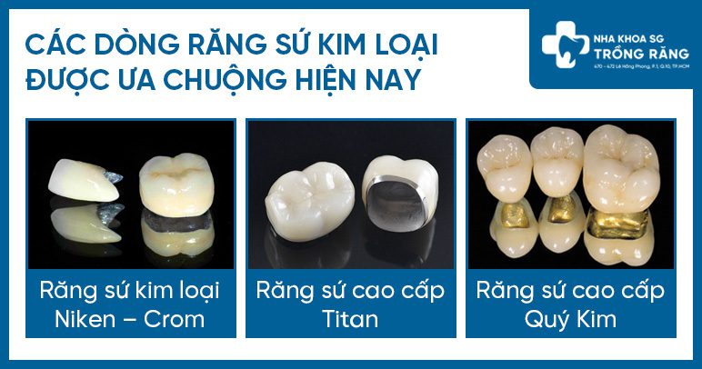 Boc rang su kim loai Bọc răng sứ kim loại
