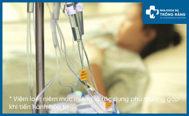 Trị Viêm loét niêm mạc miệng bằng hóa trị