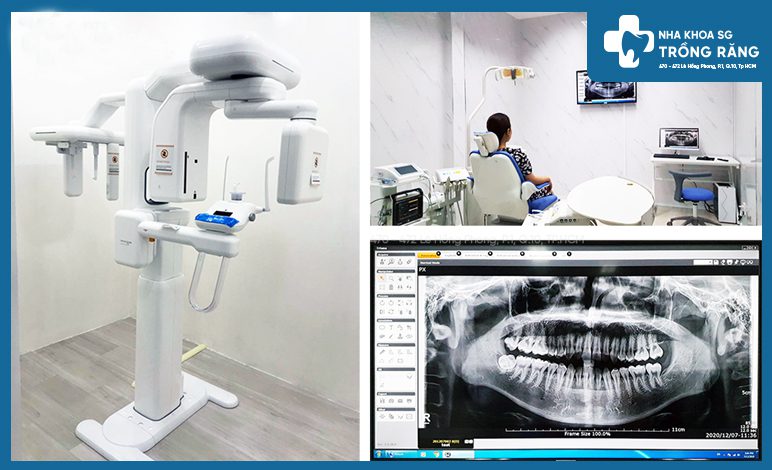 Hệ thống máy chụp ct hỗ trợ trồng răng implant được chuẩn xác