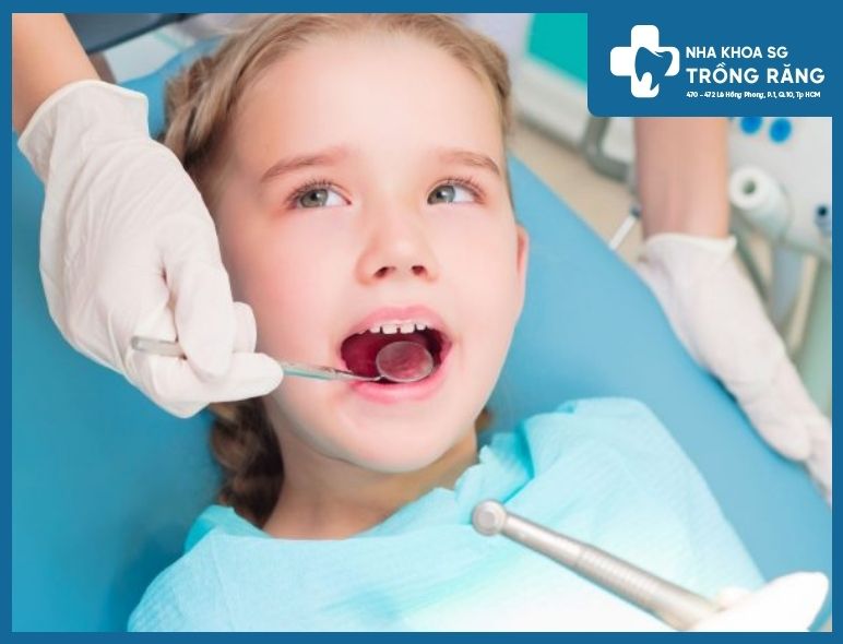trẻ em 5 tuổi trở lên có thể trám răng