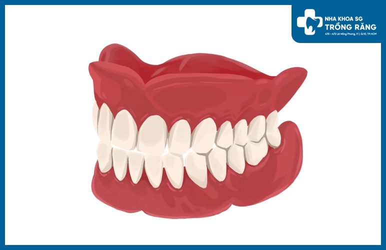 răng giả tháo lắp nhựa cứng toàn phần răng giả tháo lắp nhựa cứng toàn phần