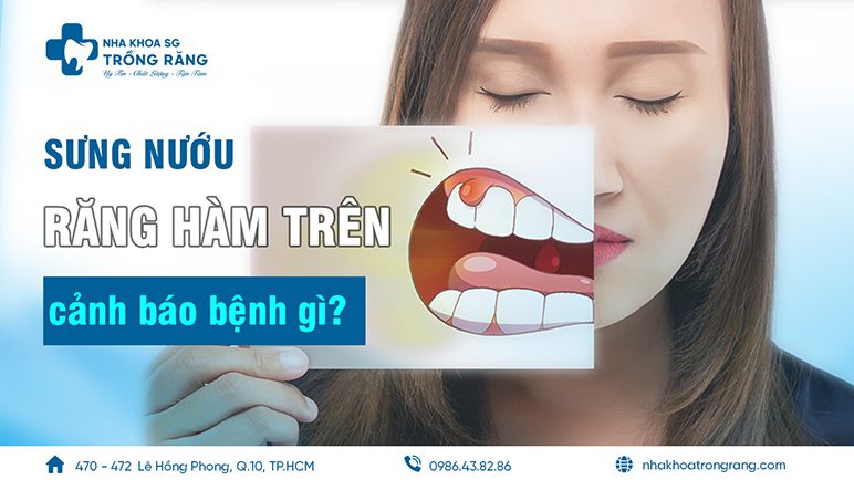 sưng nướu răng hàm trên là cảnh báo bệnh gì