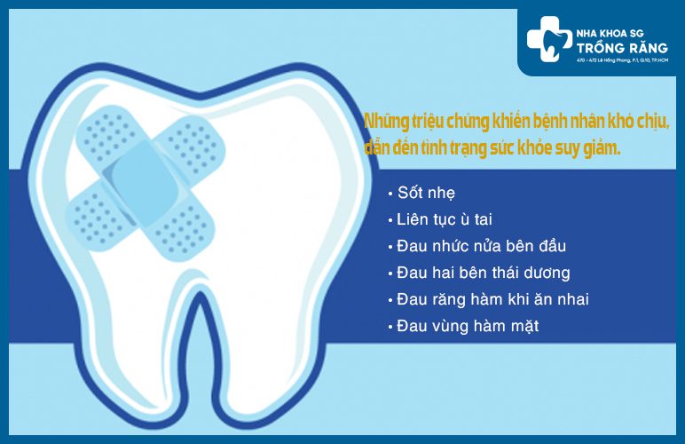 triệu chứng khi đau răng hàm