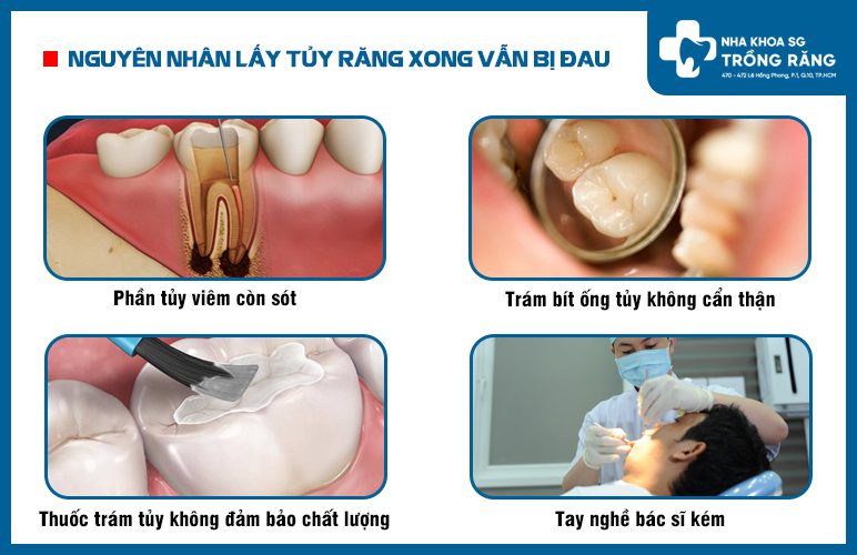Các nguyên nhân lấy tủy răng xong bị đau