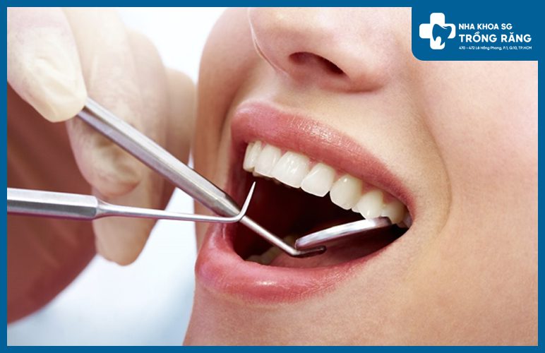 Tẩy trắng răng có hại không?
