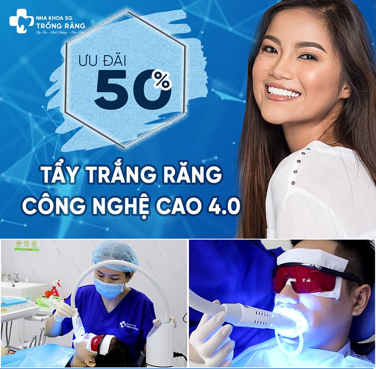 Tay trang rang cong nghe cao voi gia uu dai Tẩy trắng răng có hại không?