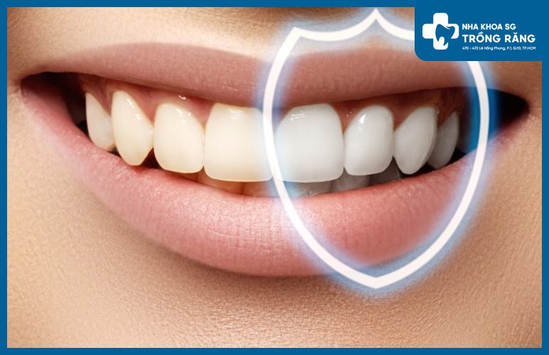 Tay trang rang nhieu co tac hai gi khong Bao lâu tẩy trắng răng 1 lần?