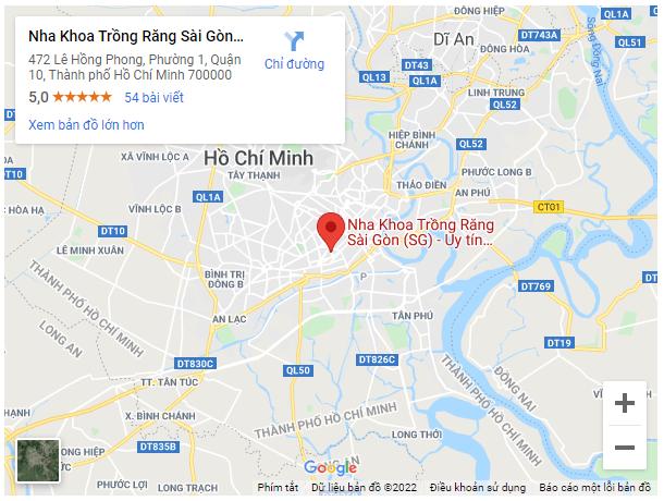 dia chi nha khoa trong rang sai gon dia chi nha khoa trong rang sai gon