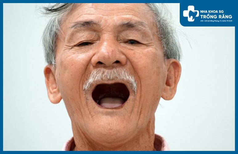 Cách khắc phục tình trạng rụng răng ở người già