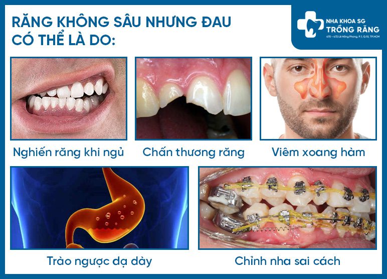 Răng không sâu nhưng bị đau - Vấn đề là do đâu?