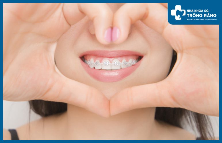 Bật mí nha khoa gần quận 4 nổi tiếng niềng răng đẹp