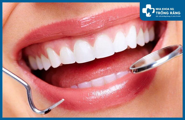 Nhung dieu can biet khi nieng rang da lay tuy Răng đã lấy tủy có niềng được không?