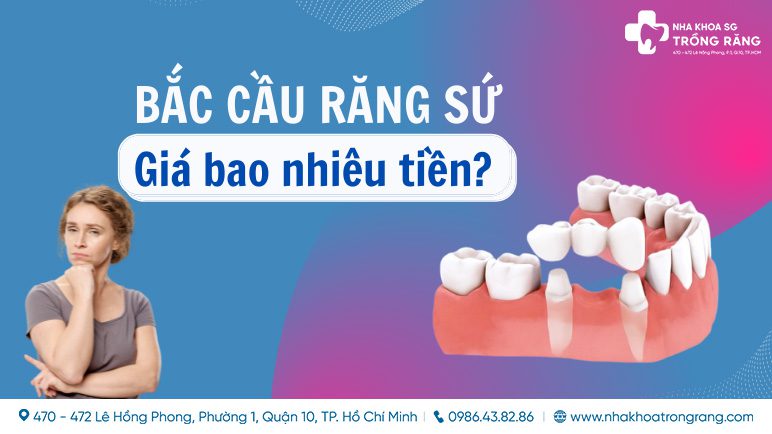 Năm 2022 bắc cầu răng sứ giá bao nhiêu tiền?