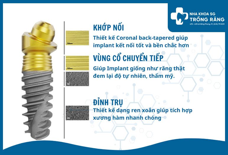 Làm răng giả bền vững trọn đời với trụ implant nobel