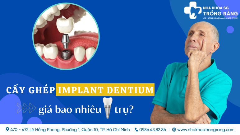 Chi phí cấy 1 trụ implant dentium là bao nhiêu?