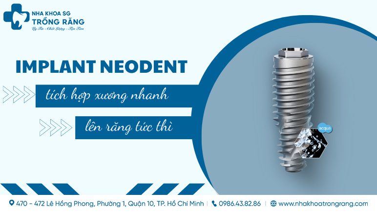 Implant neodent hỗ trợ lên răng tức thì, tích hợp nhanh