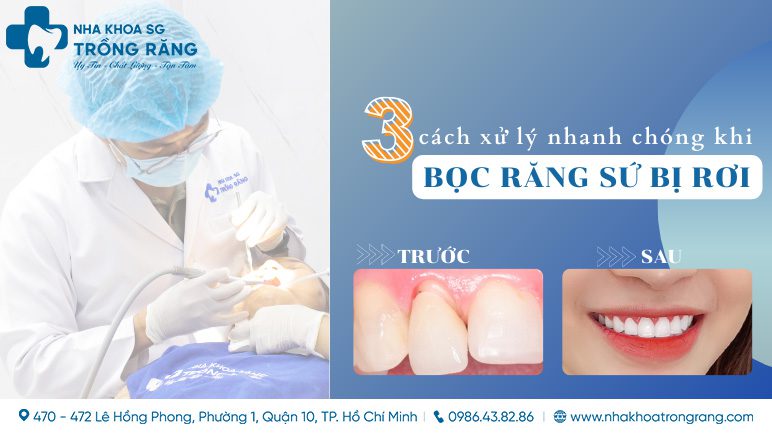 Bạn đang gặp phải tình trạng răng sứ rơi? Đừng lo lắng! Chúng tôi sẵn sàng hỗ trợ bạn trong việc xử lý răng sứ rơi một cách nhanh chóng và chuyên nghiệp nhất. Hãy đến với chúng tôi để có được một hàm răng đẹp, hoàn hảo và tự tin trong cuộc sống.