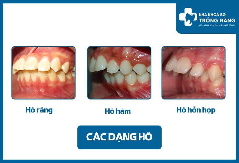 cac dang ho cac dang ho