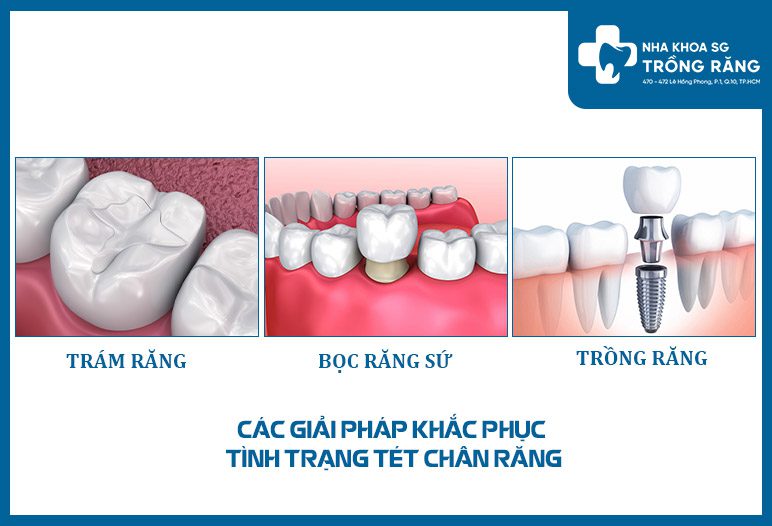chua tet chan rang chua tet chan rang