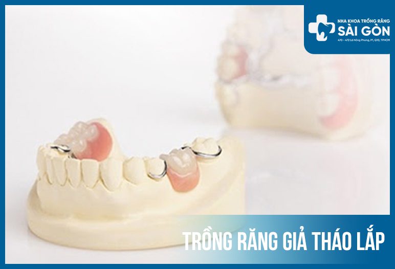 rang gia thao lap trồng răng giả tháo lắp răng số 6